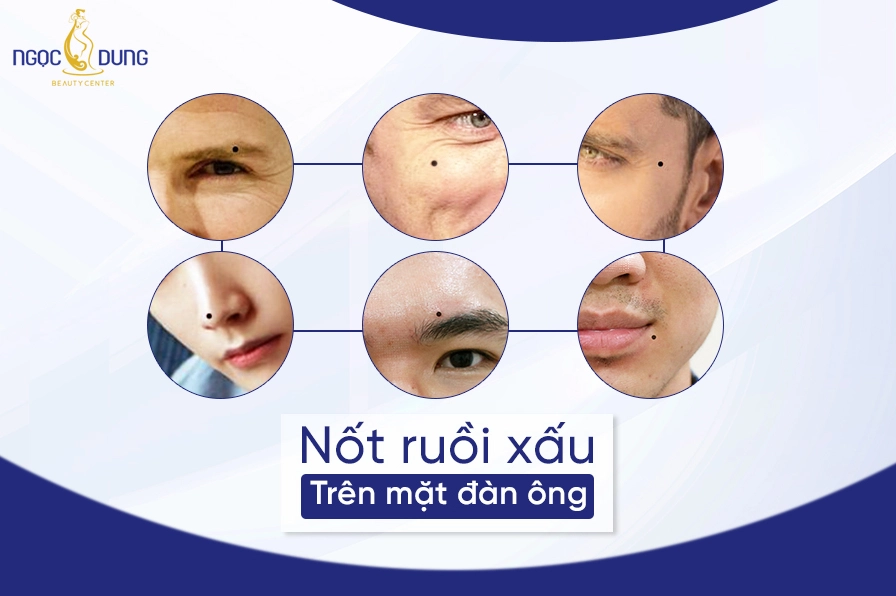 Giải mã tướng số: Xem nốt ruồi trên mặt đàn ông theo phong thủy