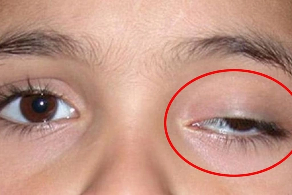 Mắt giật bên trái có điềm gì? Giải mã tâm linh hiện tượng