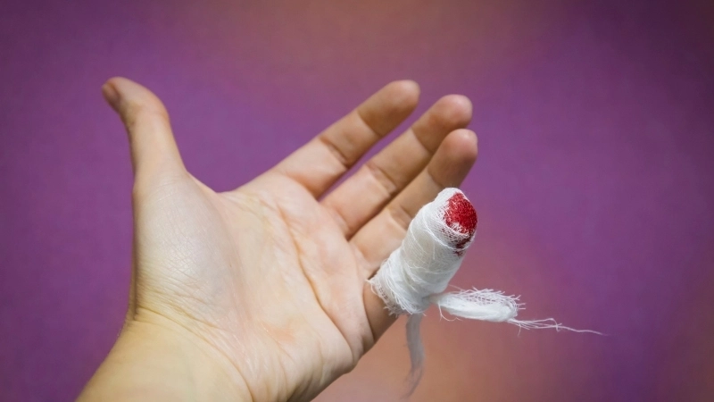 Mơ thấy mình chảy máu