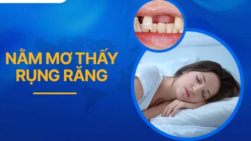 Nằm mơ thấy rụng răng báo trước điều gì về sức khỏe