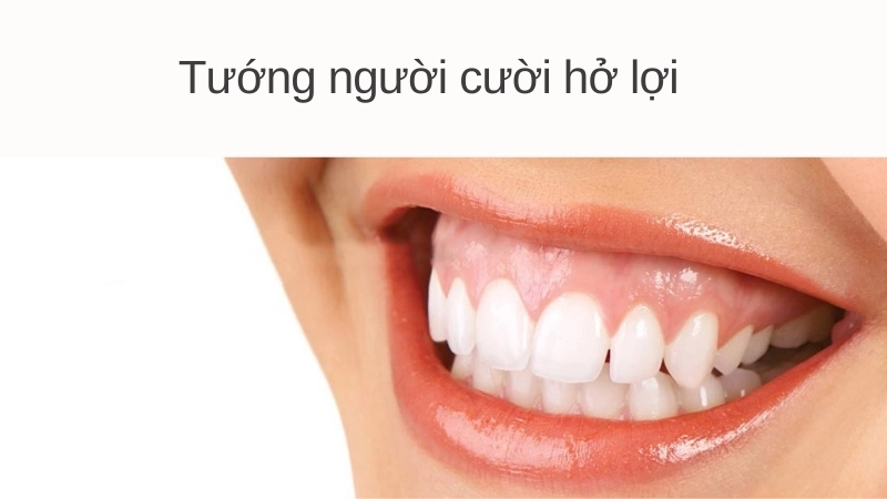 Tướng người cười hở lợi nói lên điều gì về tính cách