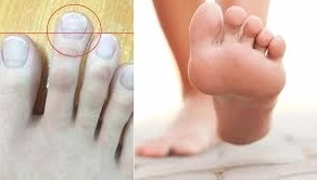 Xem Tướng Bàn Chân Nam Giới: Đoán Vận Giàu Sang, Tiết Lộ Quý Nhân