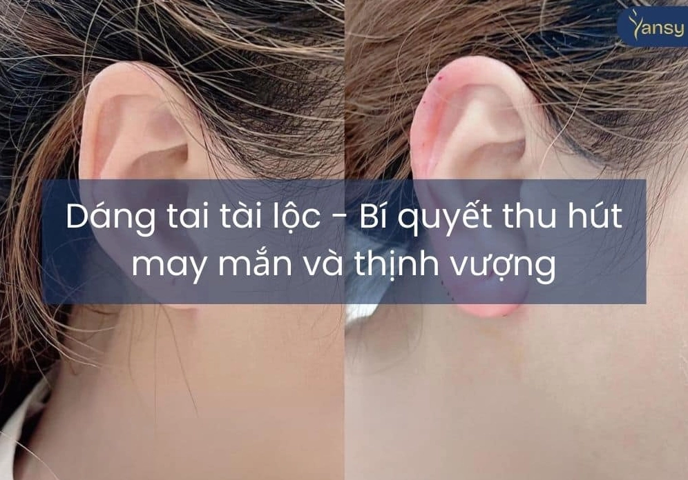 Xem Tướng Tai Đàn Ông: Dự Đoán Vận Mệnh Sang Giàu Qua Hình Dáng